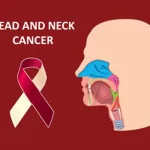 भारत में सिर और गर्दन के कैंसर के मामले बढ़े, सबसे ज्यादा खतरे में युवा : विशेषज्ञ