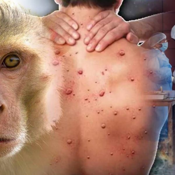 खतरनाकः अब बंदर लगवाएंगे भारत में लॉकडाउन? Monkey Pox से अभी हो जाइए सावधान!