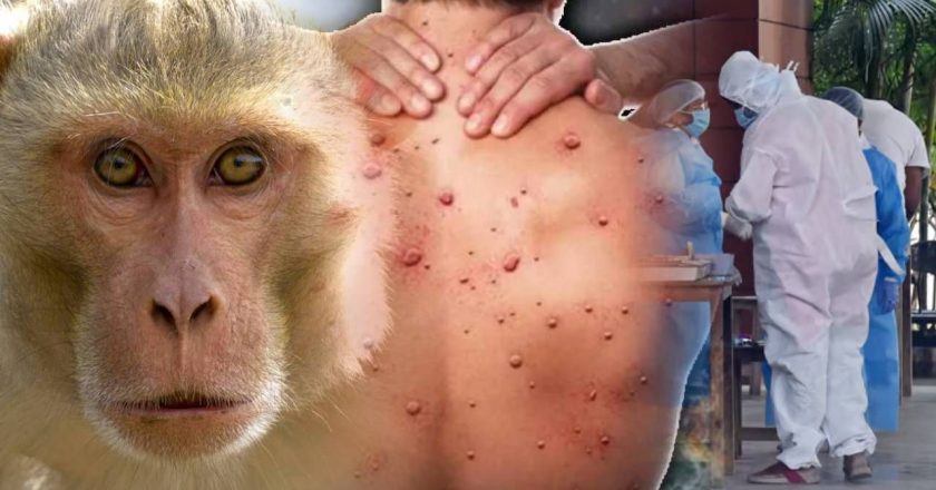 खतरनाकः अब बंदर लगवाएंगे भारत में लॉकडाउन? Monkey Pox से अभी हो जाइए सावधान!