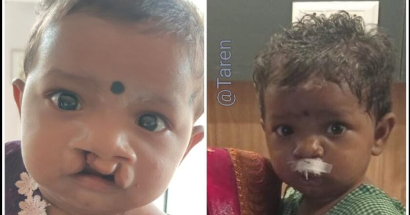 8 माह की मासूम लावन्या की मुस्कान लौटी, रायपुर में हुआ सफल ऑपरेशन, डूमरपाली युवा समिति बनी फरिश्ता