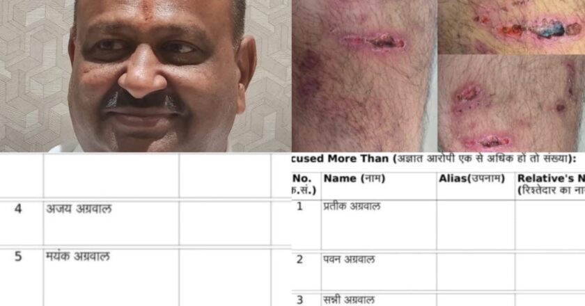 बांके बिहारी समूह में विवाद: हरविलास अग्रवाल ने कंपनी की सुरक्षा के लिए विरोध किया तो उद्योगपति और पुत्र पर हिंसक हमला.. बमुश्किल बची जान, रायपुर में 5 लोगों पर FIR दर्ज